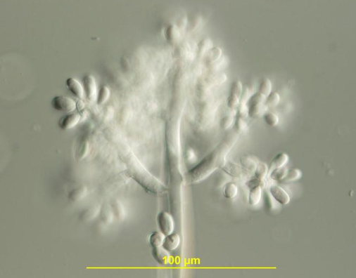 병원균의 분생포자경