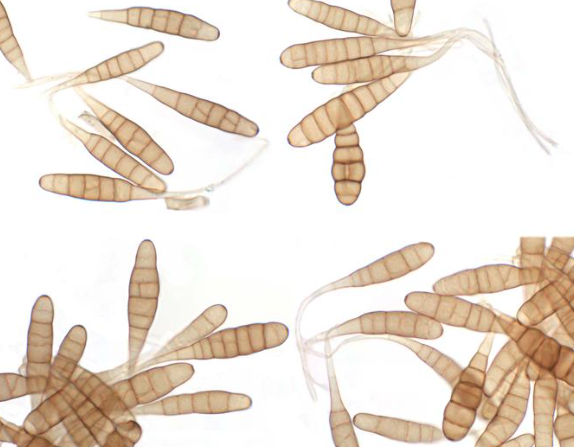 병원균(분생포자)