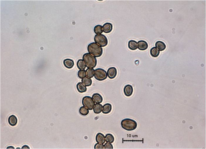 호박 무름병 병원균 포자낭포자