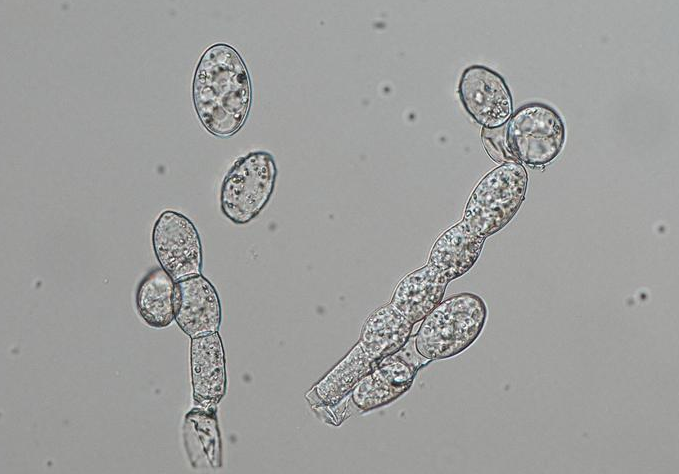 병원균(분생포자)
