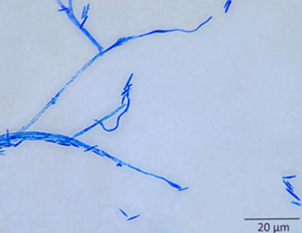 병원균(분생포자)