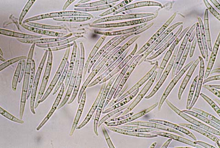 소형포자(해부현미경)와 대형포자(광학현미경)