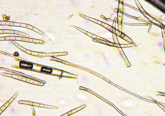 병원균(분생포자)