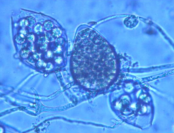 병원균(유주자낭)