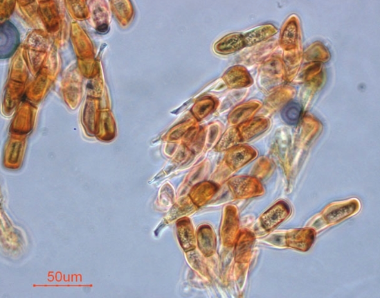 병원균(동포자)