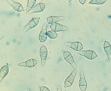 병원균(분생포자)