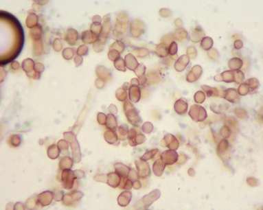 병원균(분생포자)