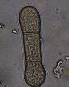 병원균(분생포자)