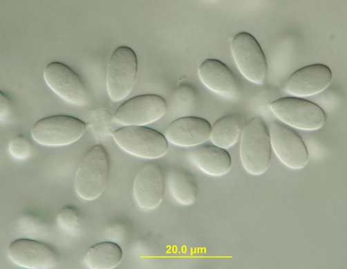 병원균의 분생포자