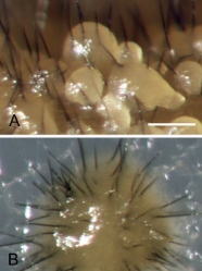 병원균(A-B 포자퇴와 강모)