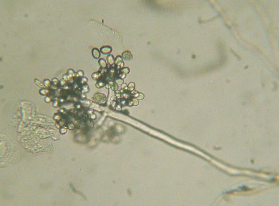 병원균(분생자경과 분생포자)