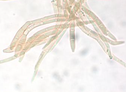 P. cruenta 분생포자