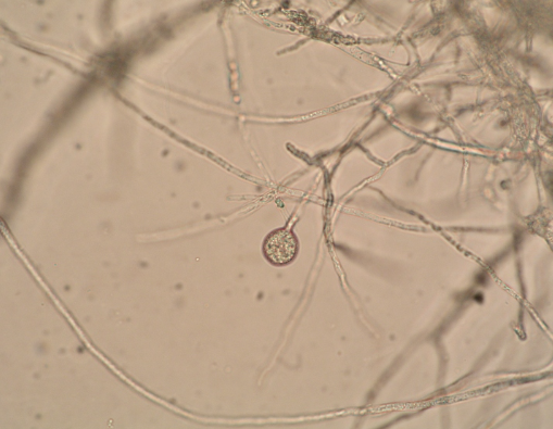 병원균(균사 및 포자)