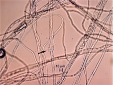 병원균(균사 접합 꺽쇠연결)