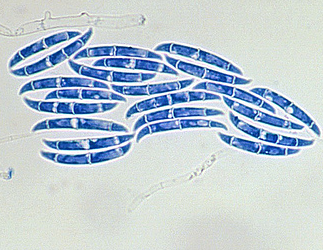  병원균(F. solani 분생포자)