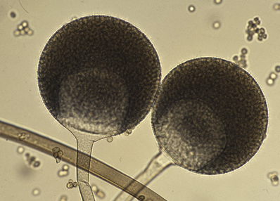 호박 무름병 병원균 포자낭