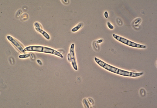  병원균(F. oxysporum)