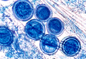 식물 조직 안의 난포자