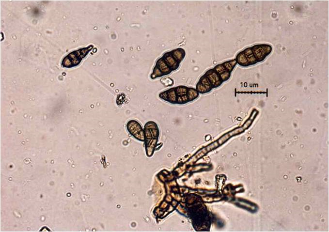 병원균(분생포자)