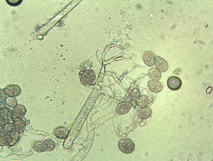 병원균(포자낭)