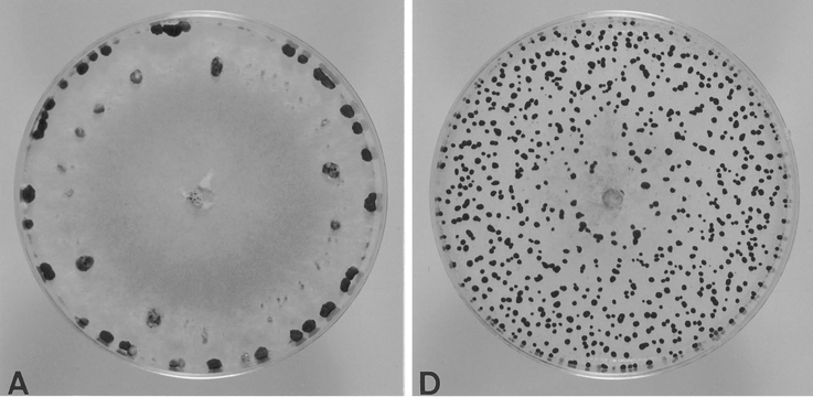 PDA 배지에 형성된 균핵,  병원균(좌 : S. sclerotiorum, 우 : S. minor)