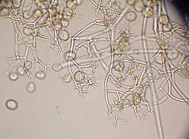 병원균(포자낭병 및 포자낭)