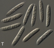 병원균(분생포자)