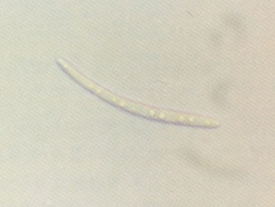 병원균(분생포자)