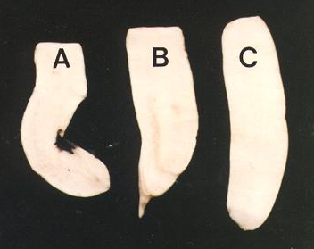 결핍 증상(A,B)과 정상(C)