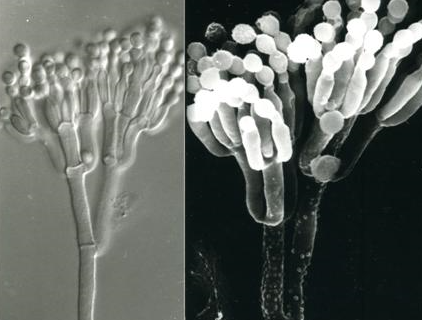 병원균(분생포자)