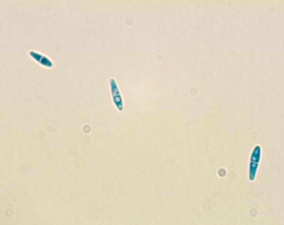 병원균(자낭포자)