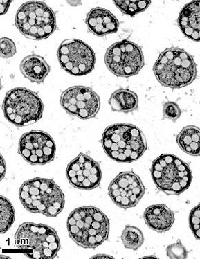 병원균(휴면포자)