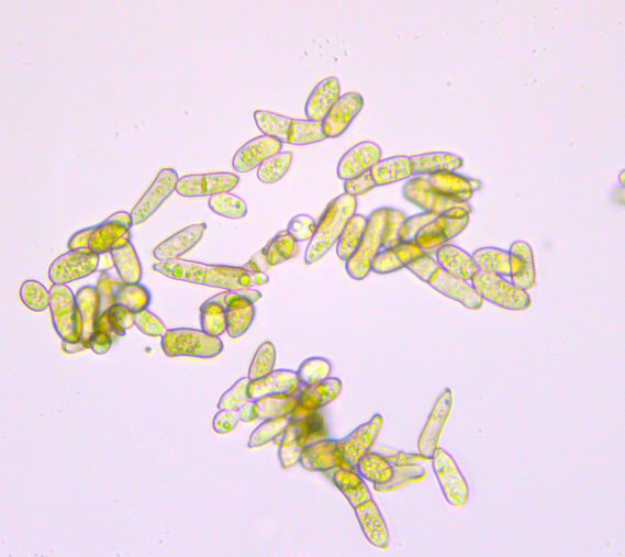병원균(분생포자)