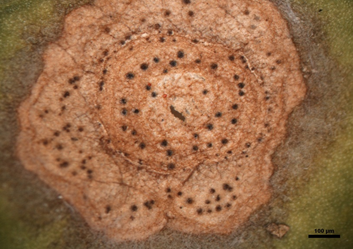 병반에 형성된 병자각