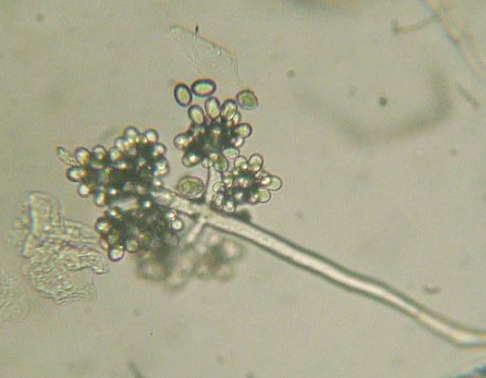 병원균(분생포자)  