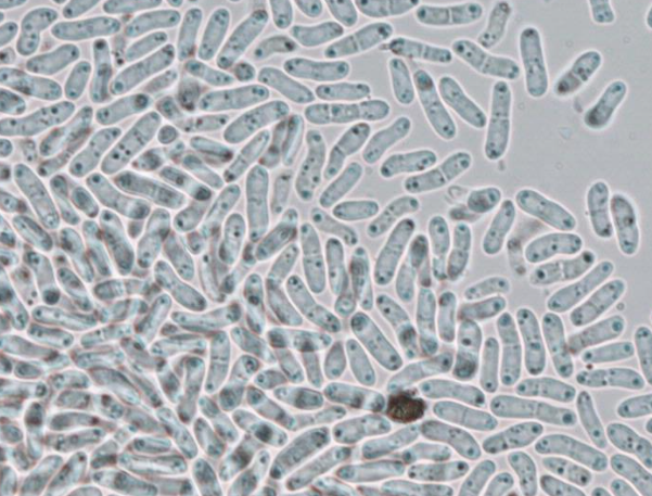 병원균(병포자)
