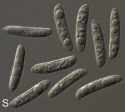 병원균(분생포자)