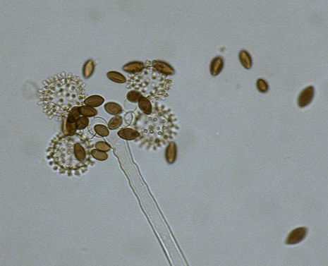 병원균(분생포자)