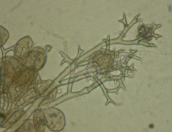 병원균(포자낭경 및 포자낭)
