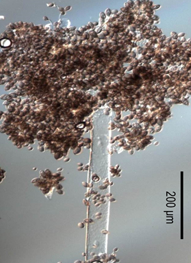 병원균(분생자경)