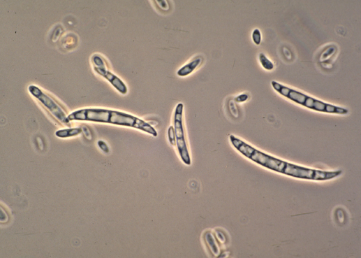  병원균(분생포자) 