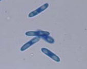 C. trifolii 분생포자