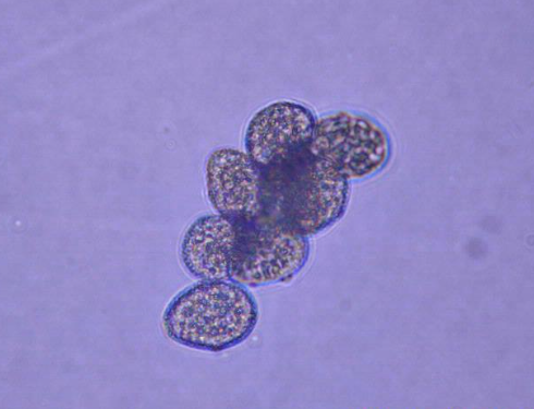 병원균(하포자)