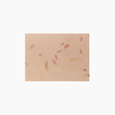 병원균(분생포자)  