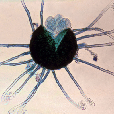 병원균의 자낭각과 자낭