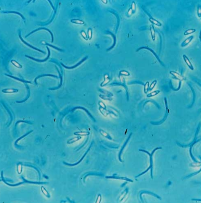 병원균(병포자)                  