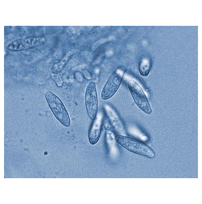 병원균(병포자)
