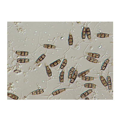 병원균(분생포자)