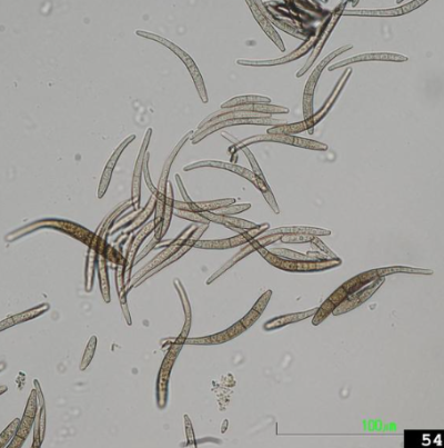 병원균(분생포자) 