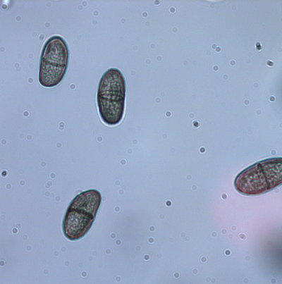 병원균(병포자)